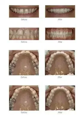 Duxton Dental: Restoring Beauty with Innovative Care in Christchurch