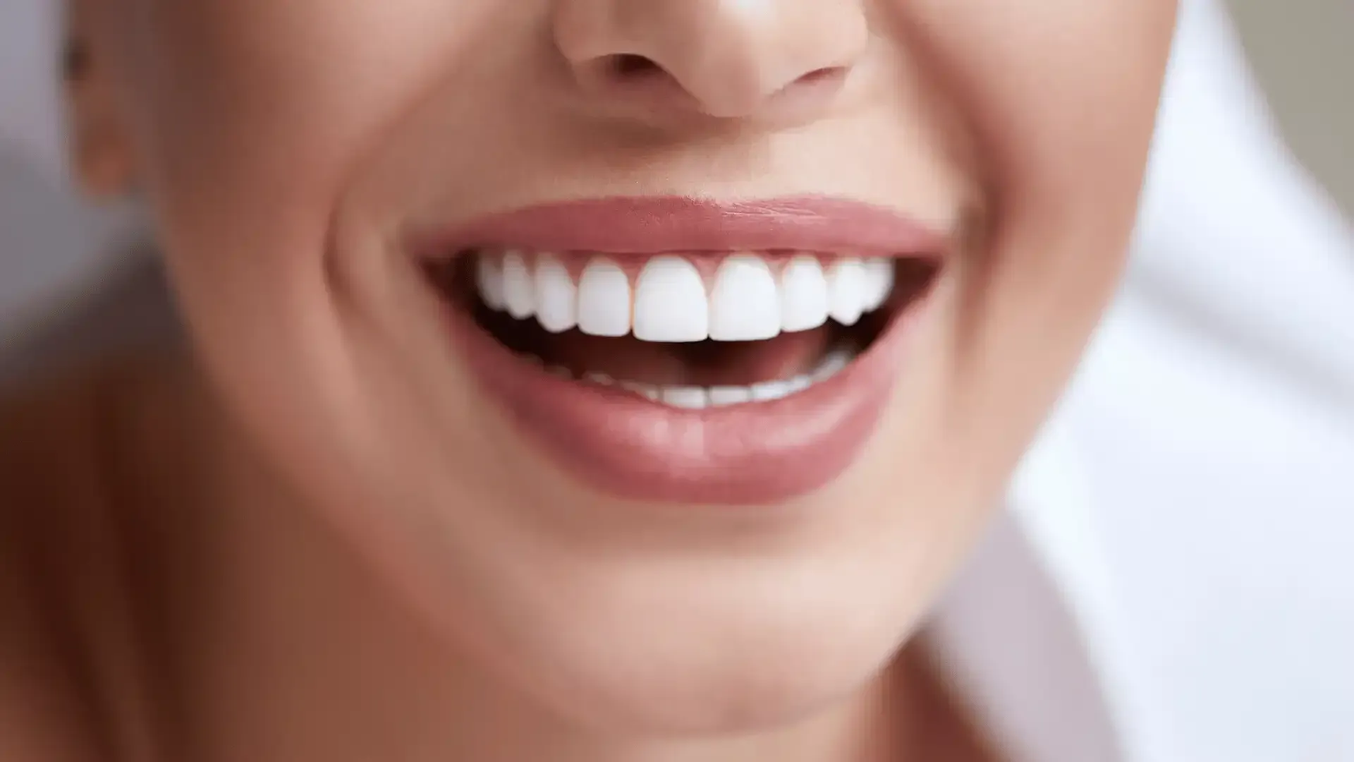 A close up of a woman 's smile with white teeth.