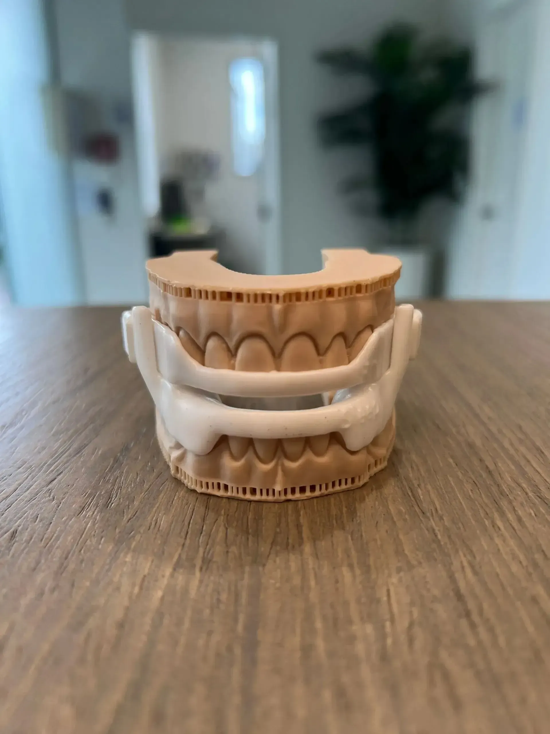 A dental appliance model of teeth with a white support structure on a wooden table.