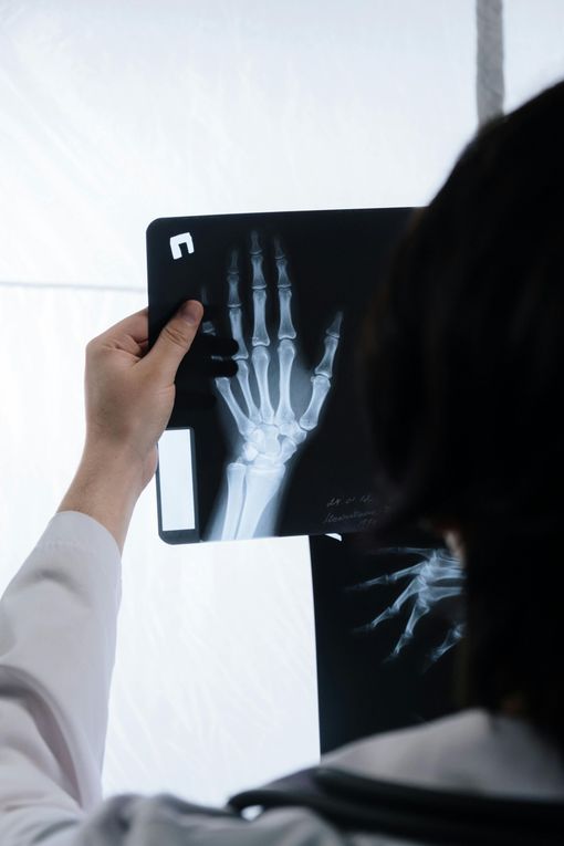 Person holding up a hand X-ray in front of a lightbox