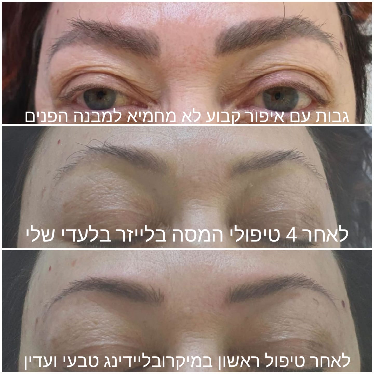 מיקרובליידינג גבות