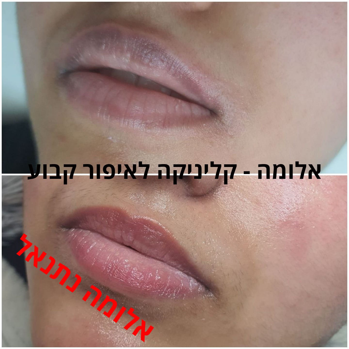 איפור קבוע שפתיים