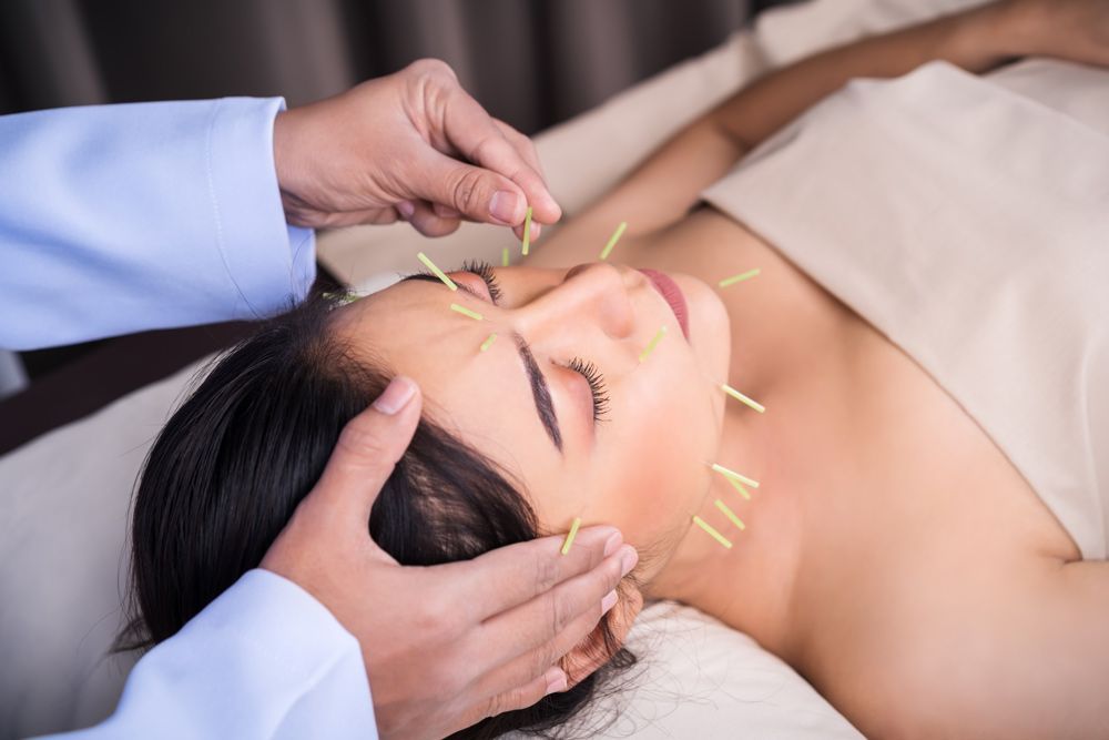 A Woman Is Getting An Acupuncture Treatment On Her Face — Resonance Health Studio in Wauchope, NSW