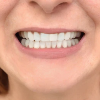 Close-up of a person's smiling mouth showing a row of white, straight teeth.