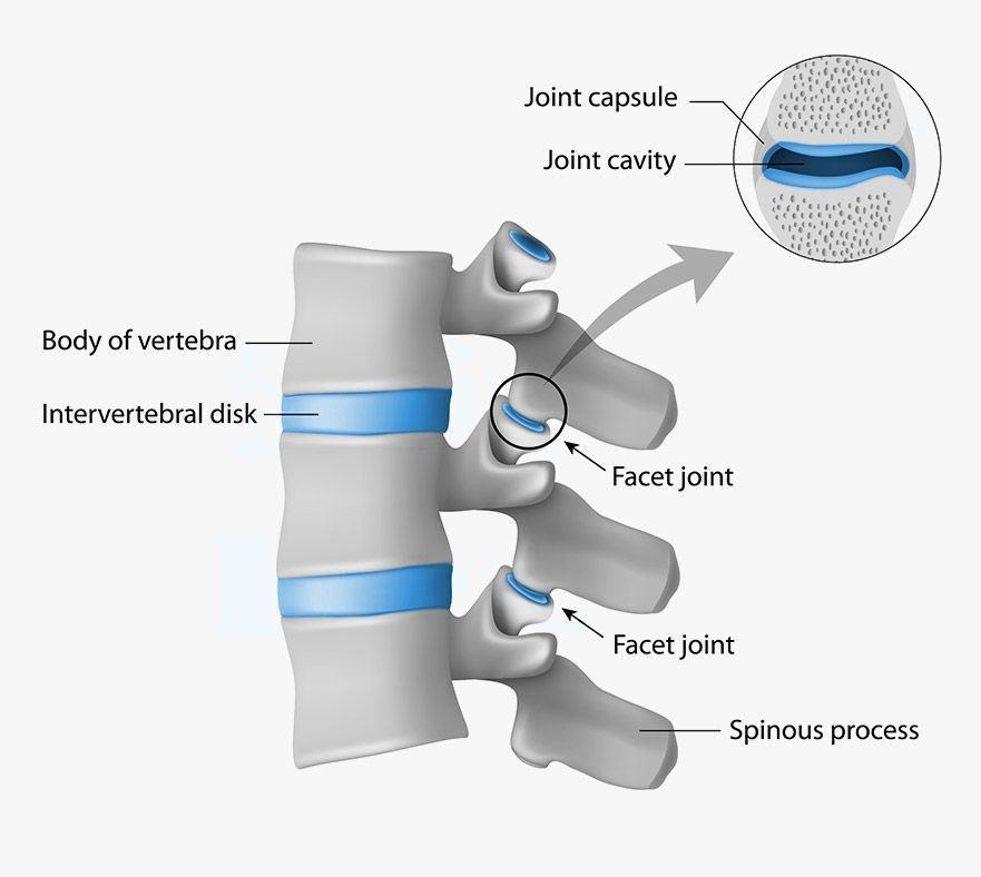 Diagram of vertebrae showing intervertebral disks, facet joints, and labeled parts of a spinal joint.
