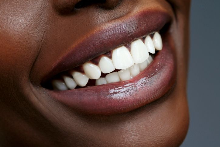 A close up of a woman 's smile with a towel around her head.