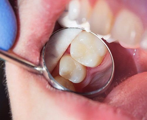 Smiling middle age woman at the dentist for preventative dental care
