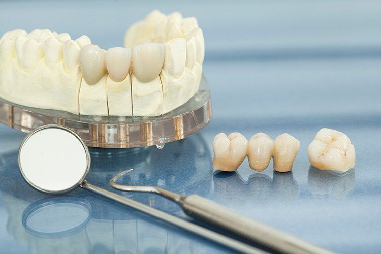 Smiling middle age woman at the dentist for preventative dental care