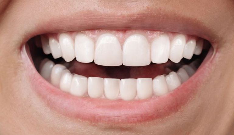 After Orthodontics