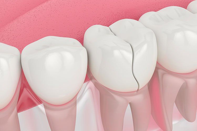 Smiling middle age woman at the dentist for preventative dental care