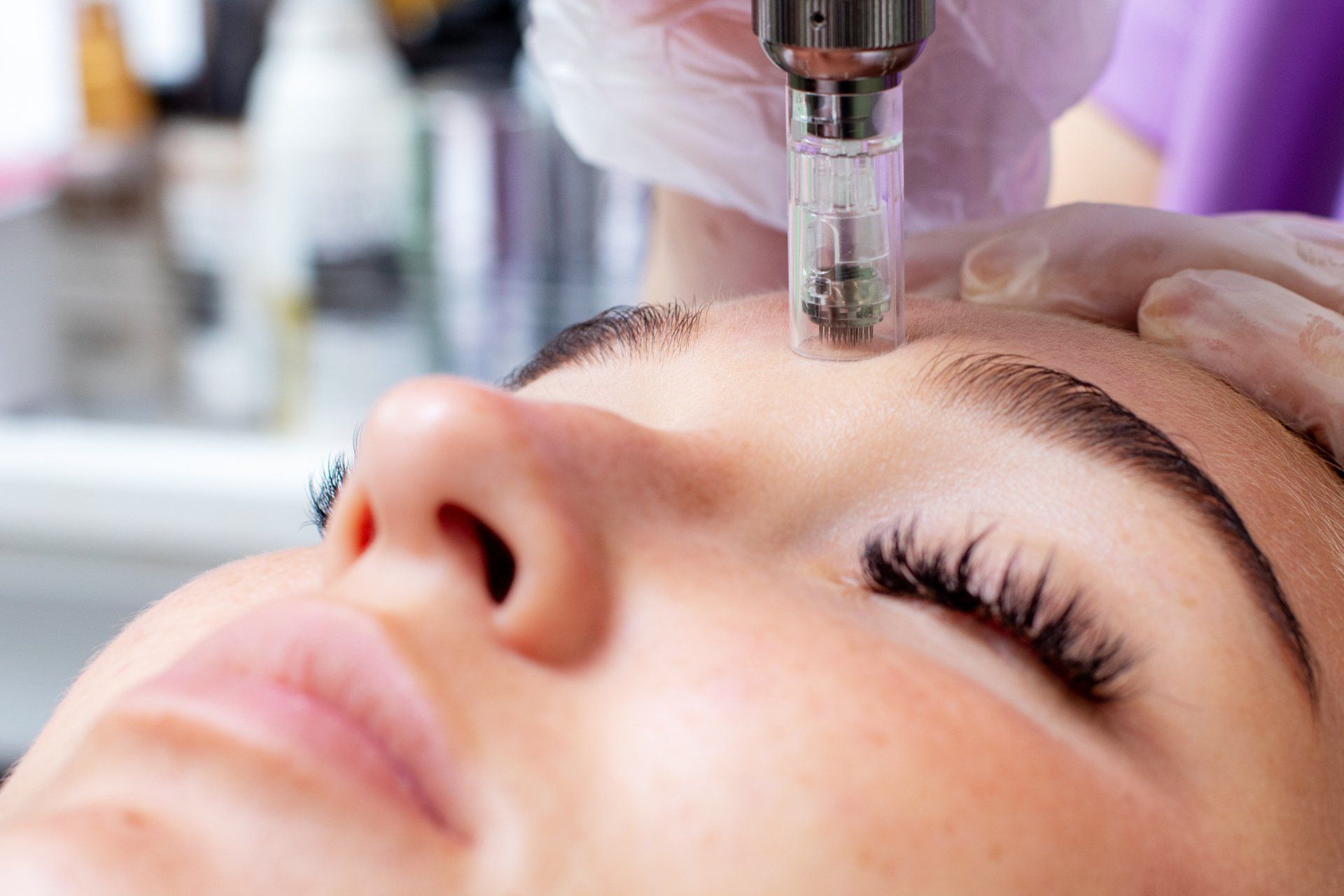 Premium-Kosmetik, Microneedling 
