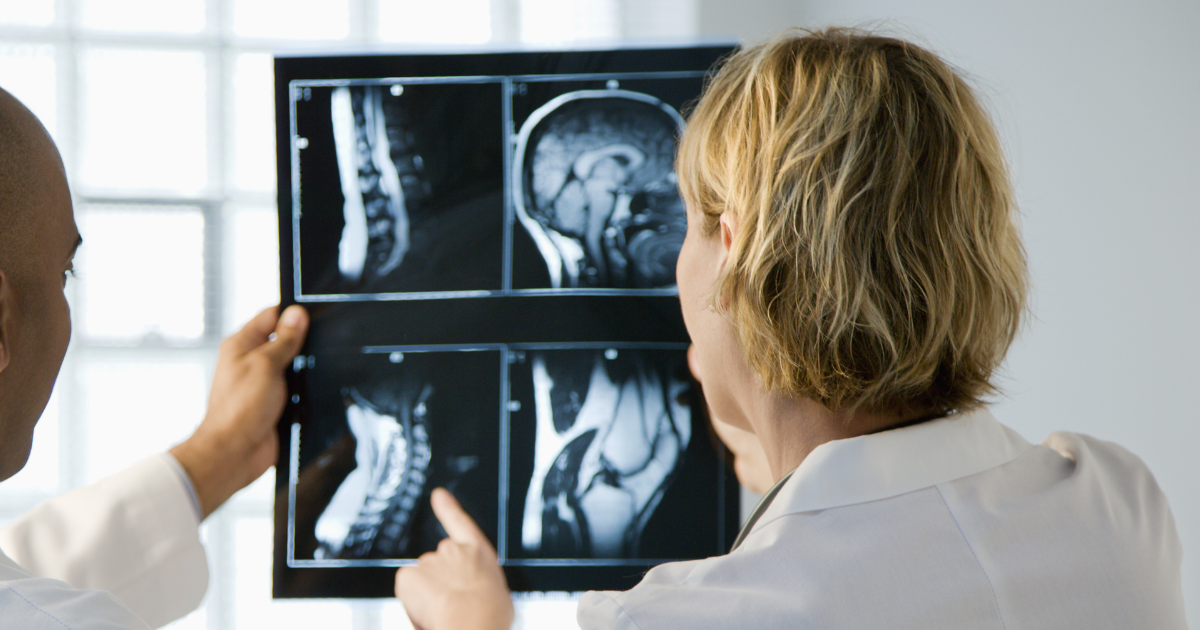 Two medical professionals reviewing spinal X-ray and MRI scans on a lightbox in a clinic