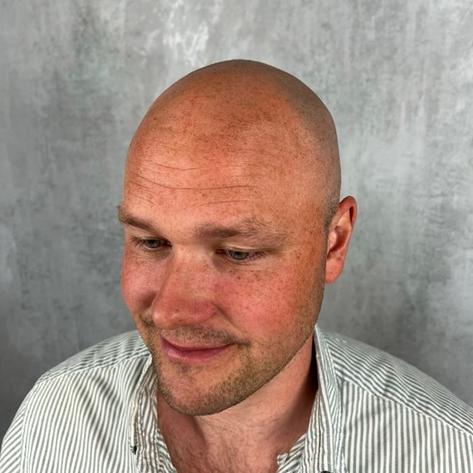 Närbild av en flintskallig man i randig skjorta som tittar ner mot en grå bakgrund
