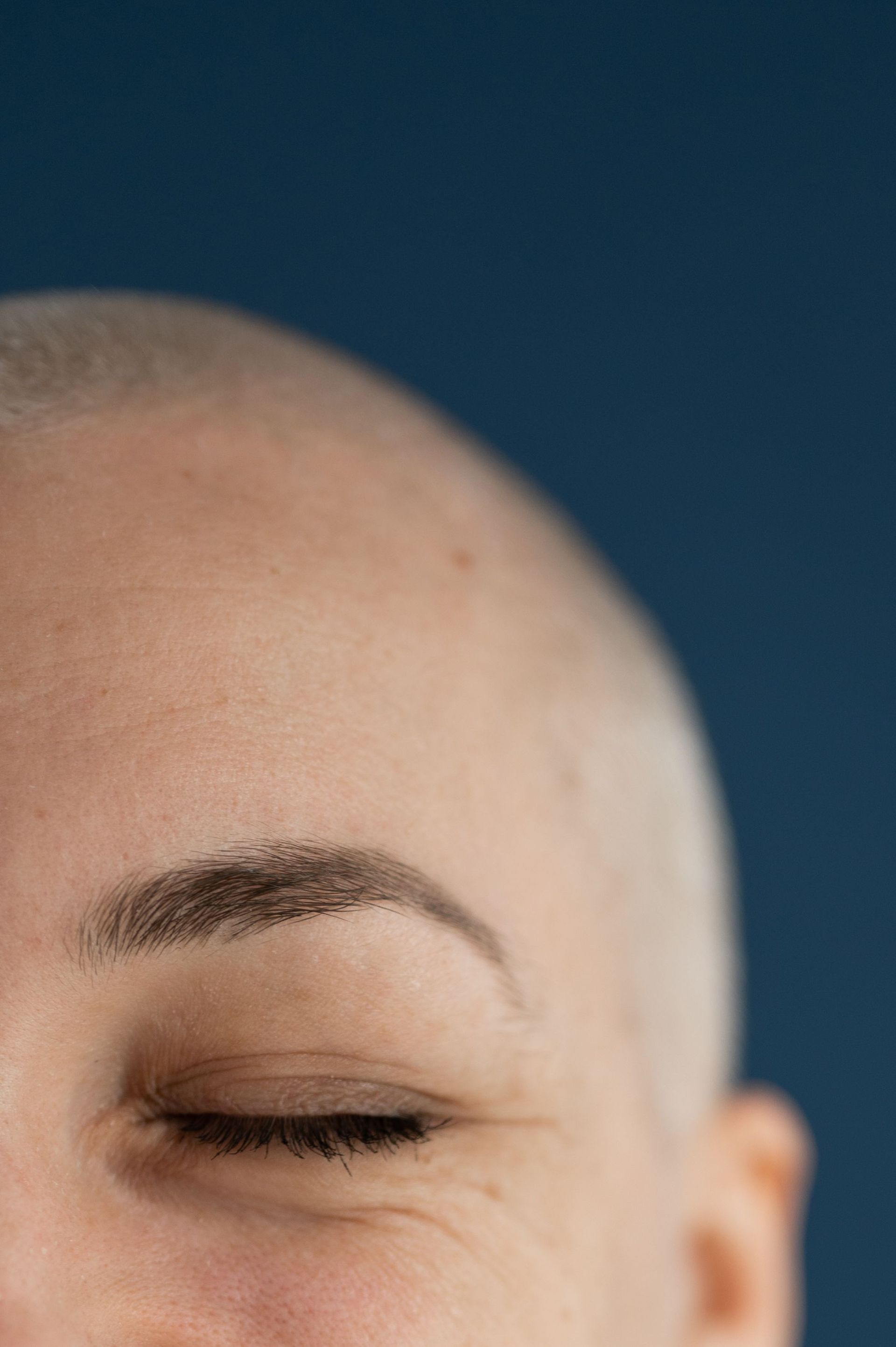 Rakat huvud och slutna ögon mot mörkblå bakgrund, illustrerar håravfall och scalp micropigmentation.
