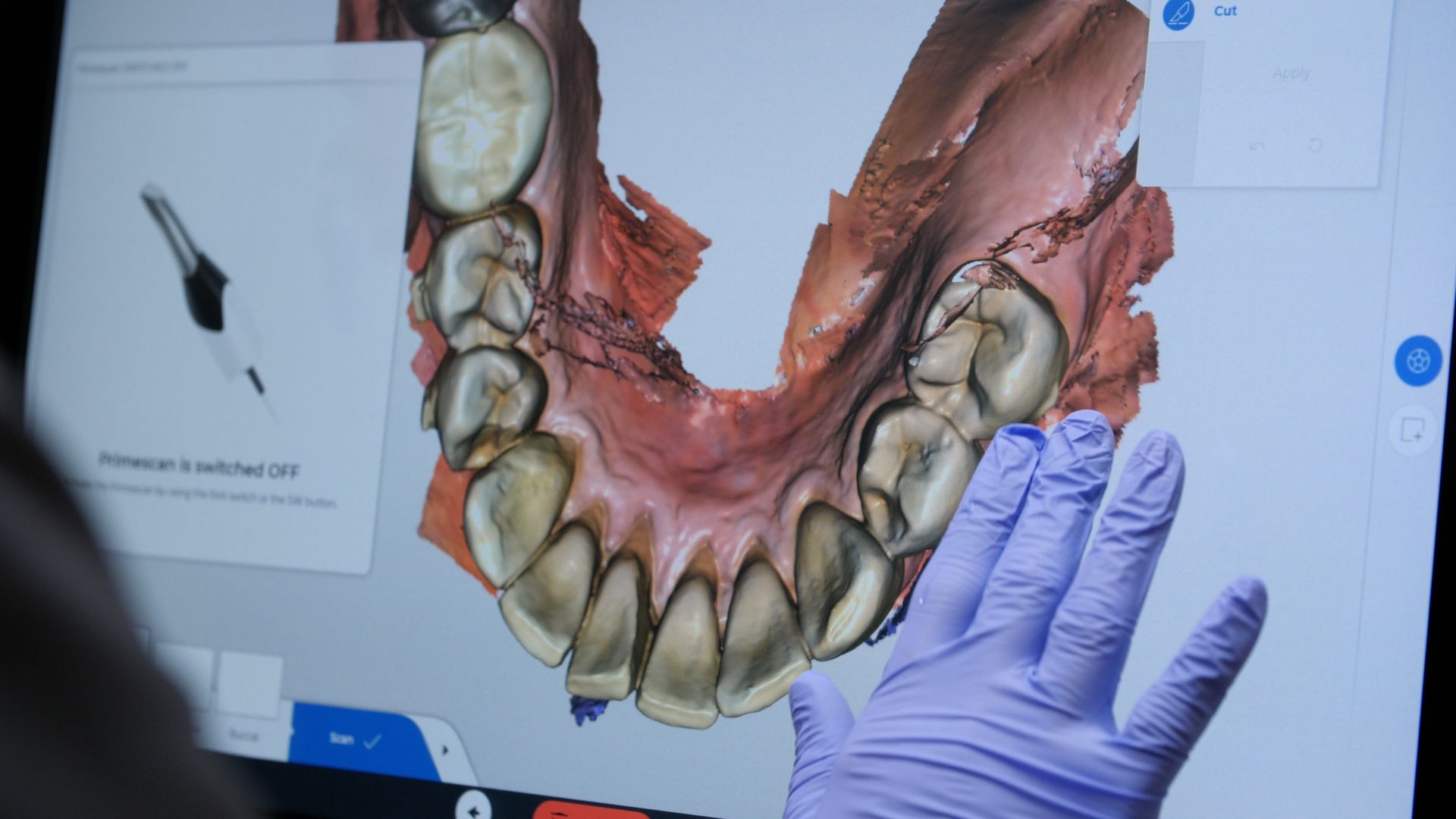 A dental office with a monitor and a light.