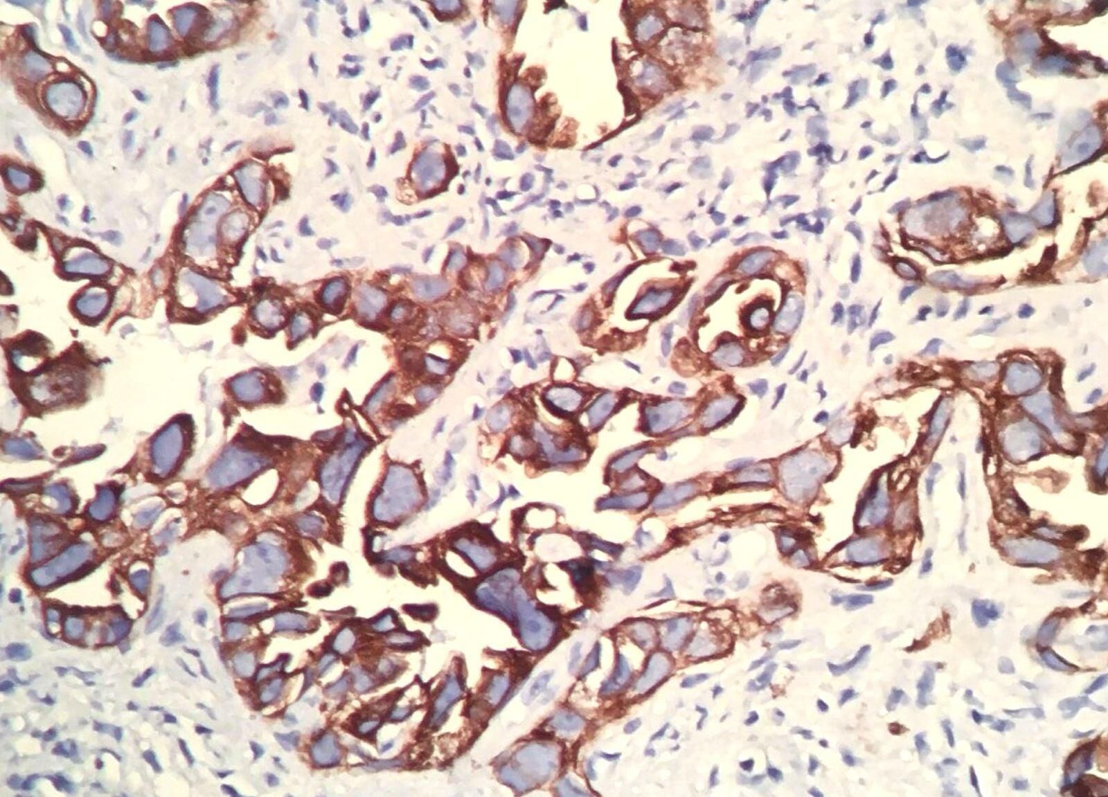 LAEP LABORATORIO PATOLÓGICO