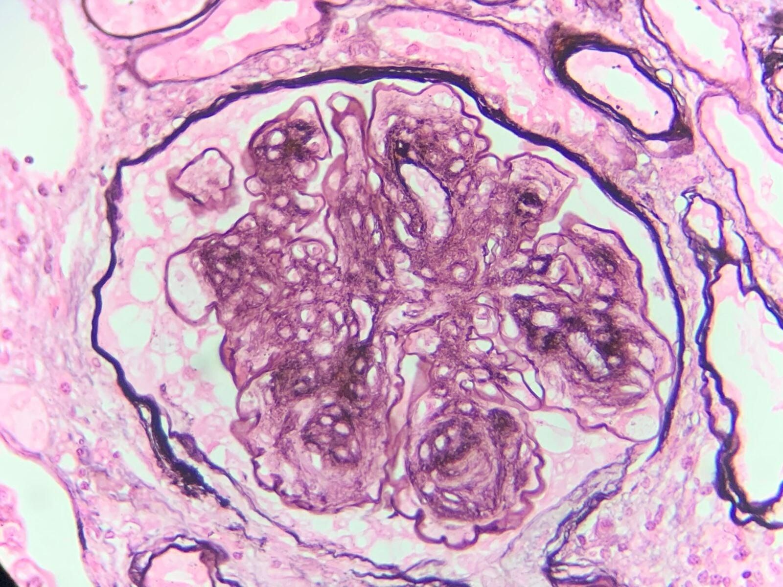 LAEP LABORATORIO PATOLÓGICO