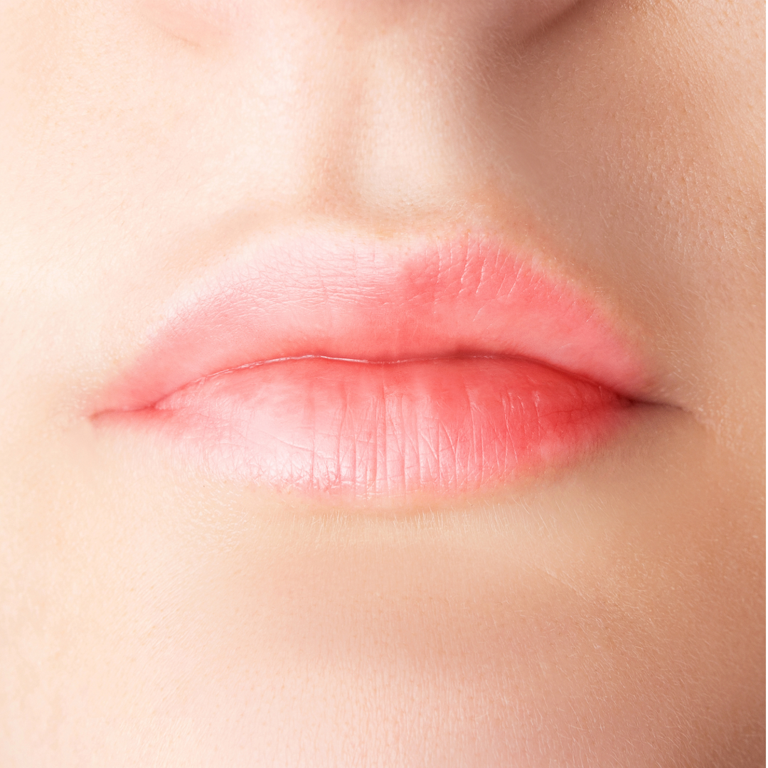 Amazing results on lips at Nouvelle Beaute in Kilmarnock