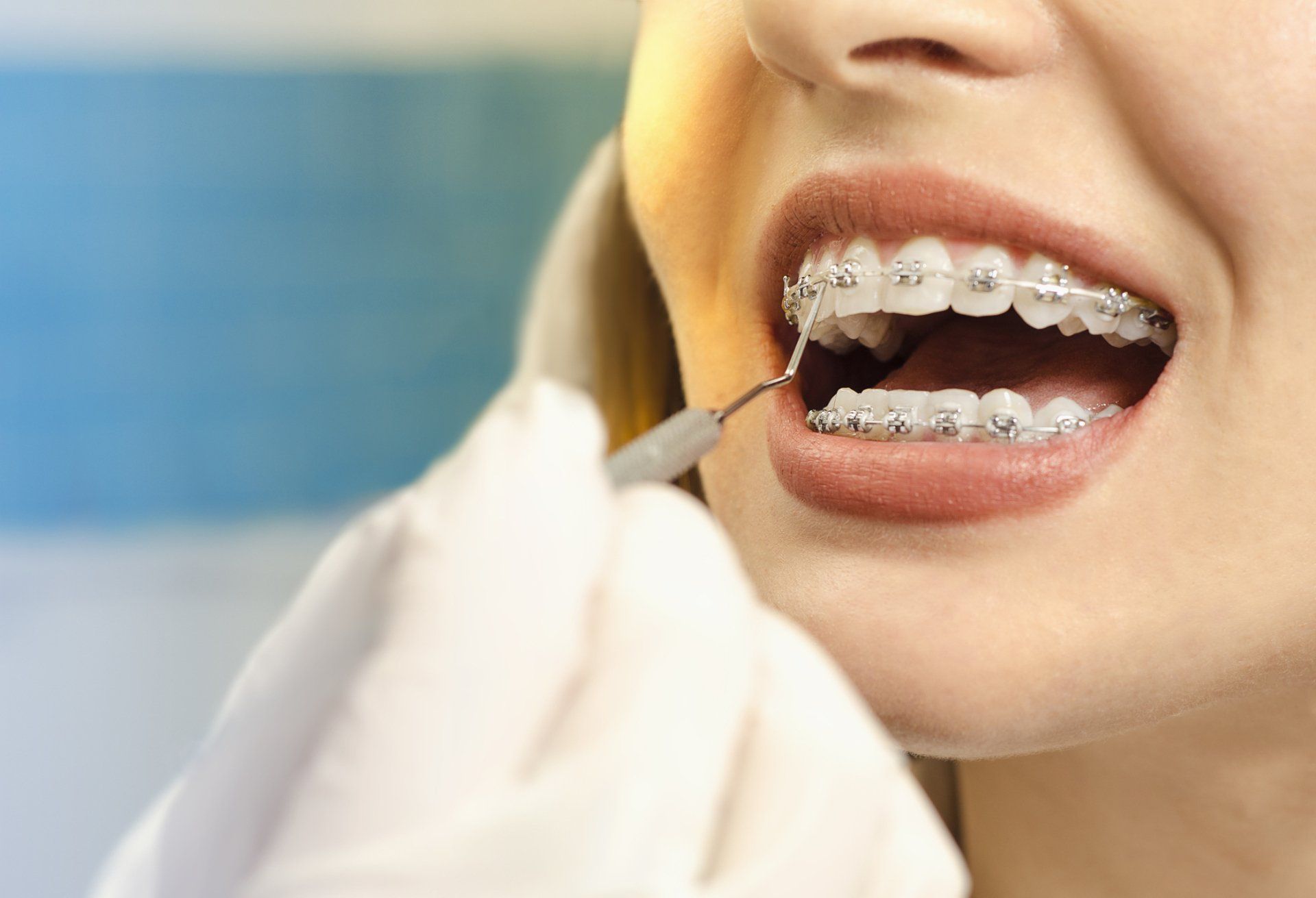 Braces
