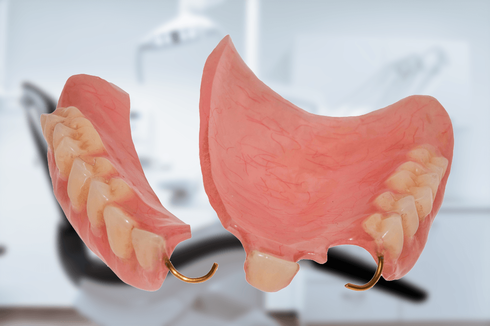 denture repairs
