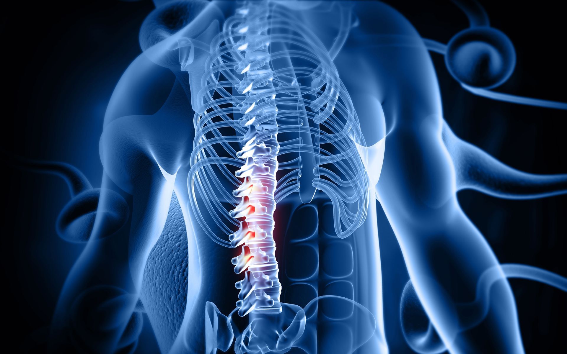 Degenerative Disc Disease Chiropractic Treatment in Adelaide