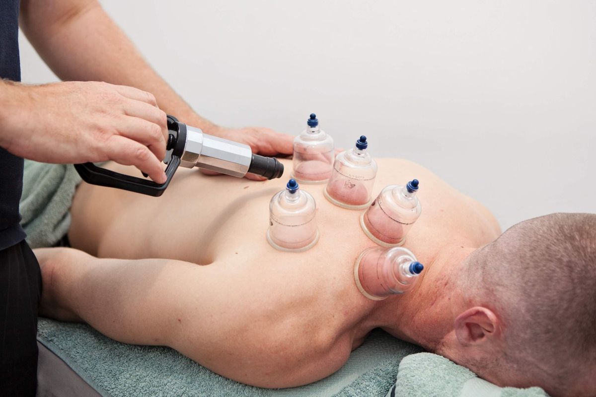 Myofascial Cupping Adelaide