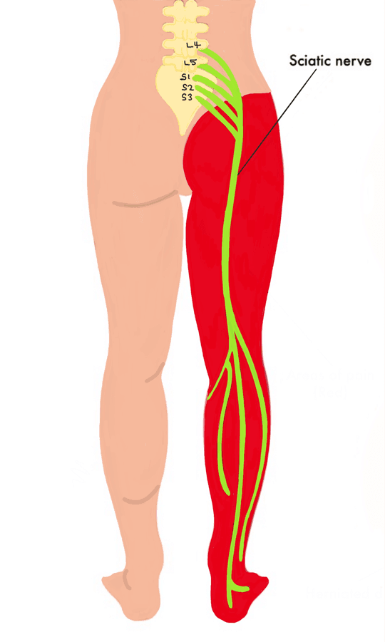 Sciatic Nerve Diagram