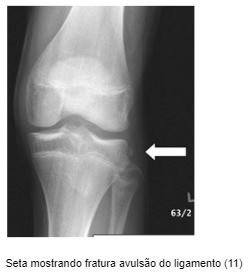 Entenda Seu Joelho