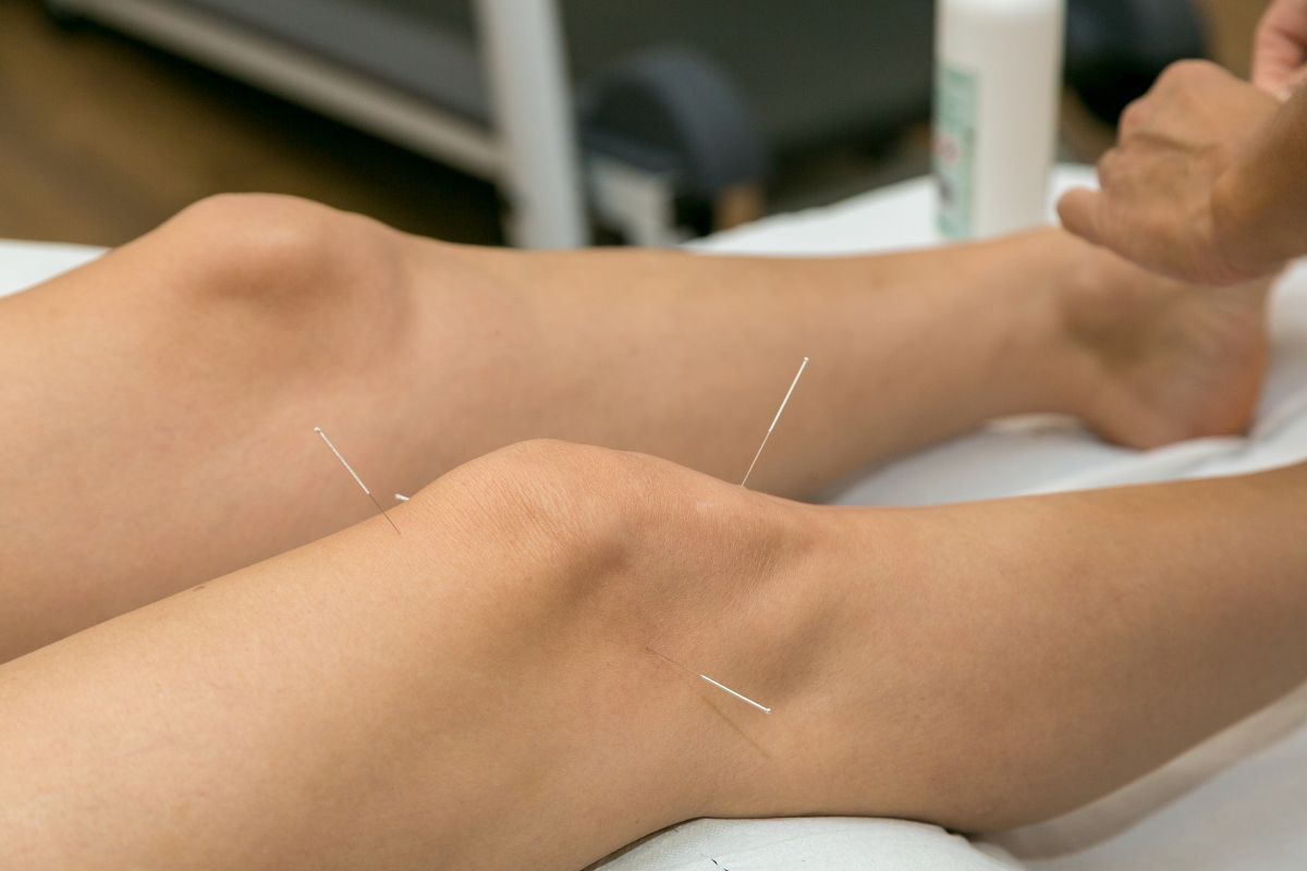 Acupuntura no tratamento da artrose no joelho: existe comprovação científica?