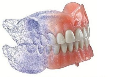 Denture model