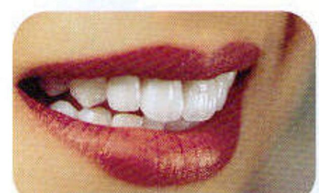 Teeth