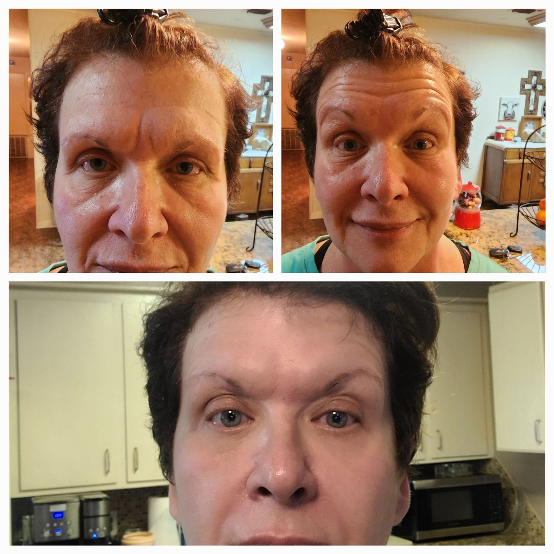 A before and after photo of a woman 's face