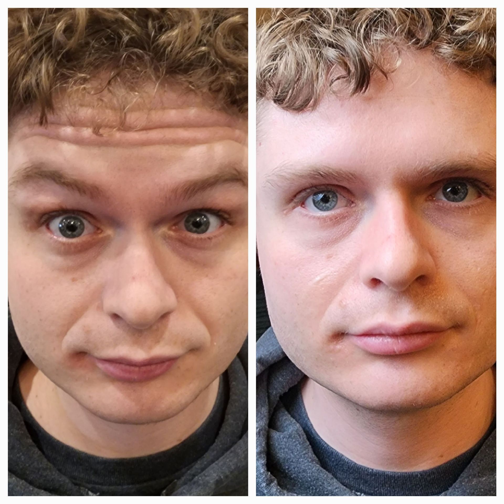 A before and after picture of a man 's face with curly hair.