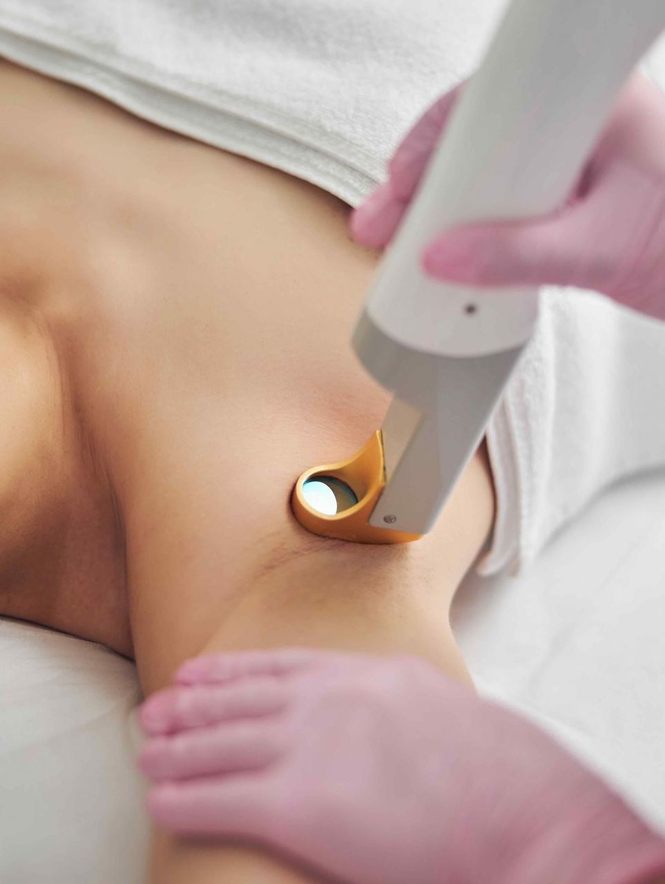 A woman is getting a laser hair removal treatment on her underarm.