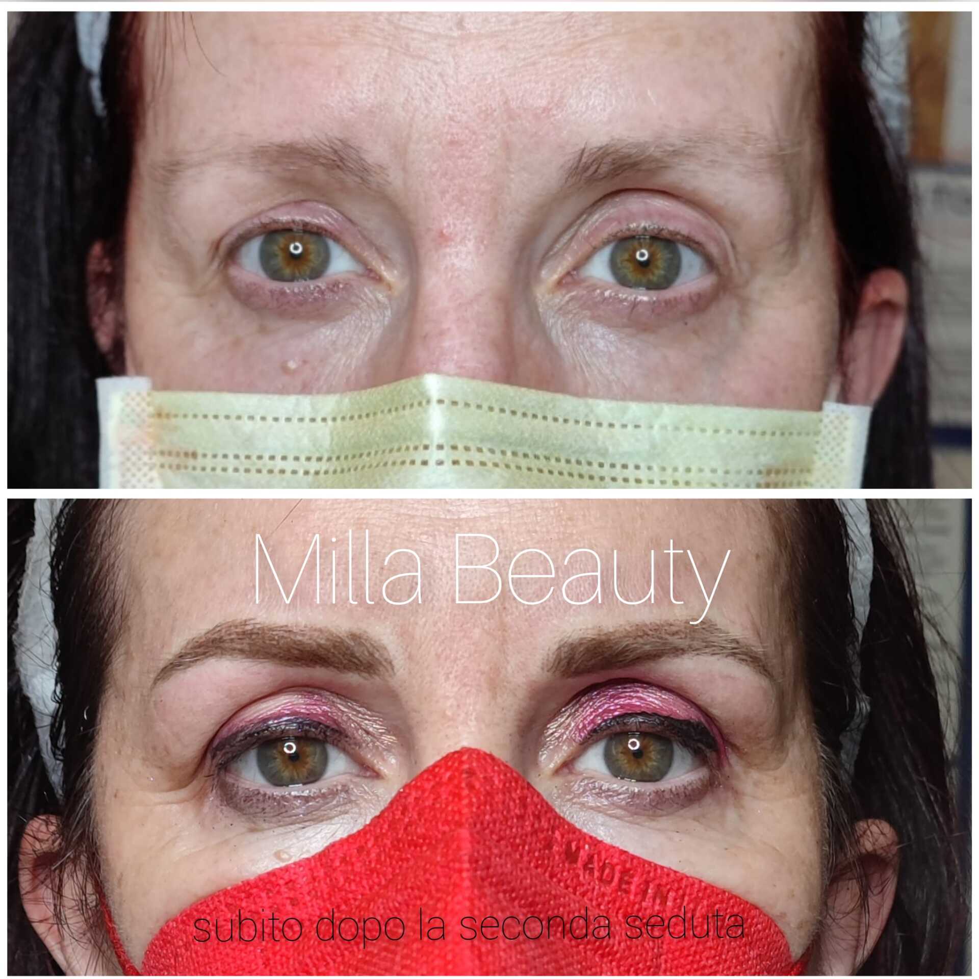 Prima e dopo il microblading delle sopracciglia: l'immagine in alto mostra sopracciglia rade