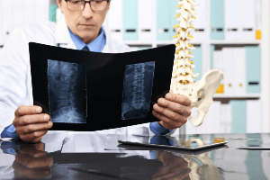 A doctor is looking at an x-ray of a spine.