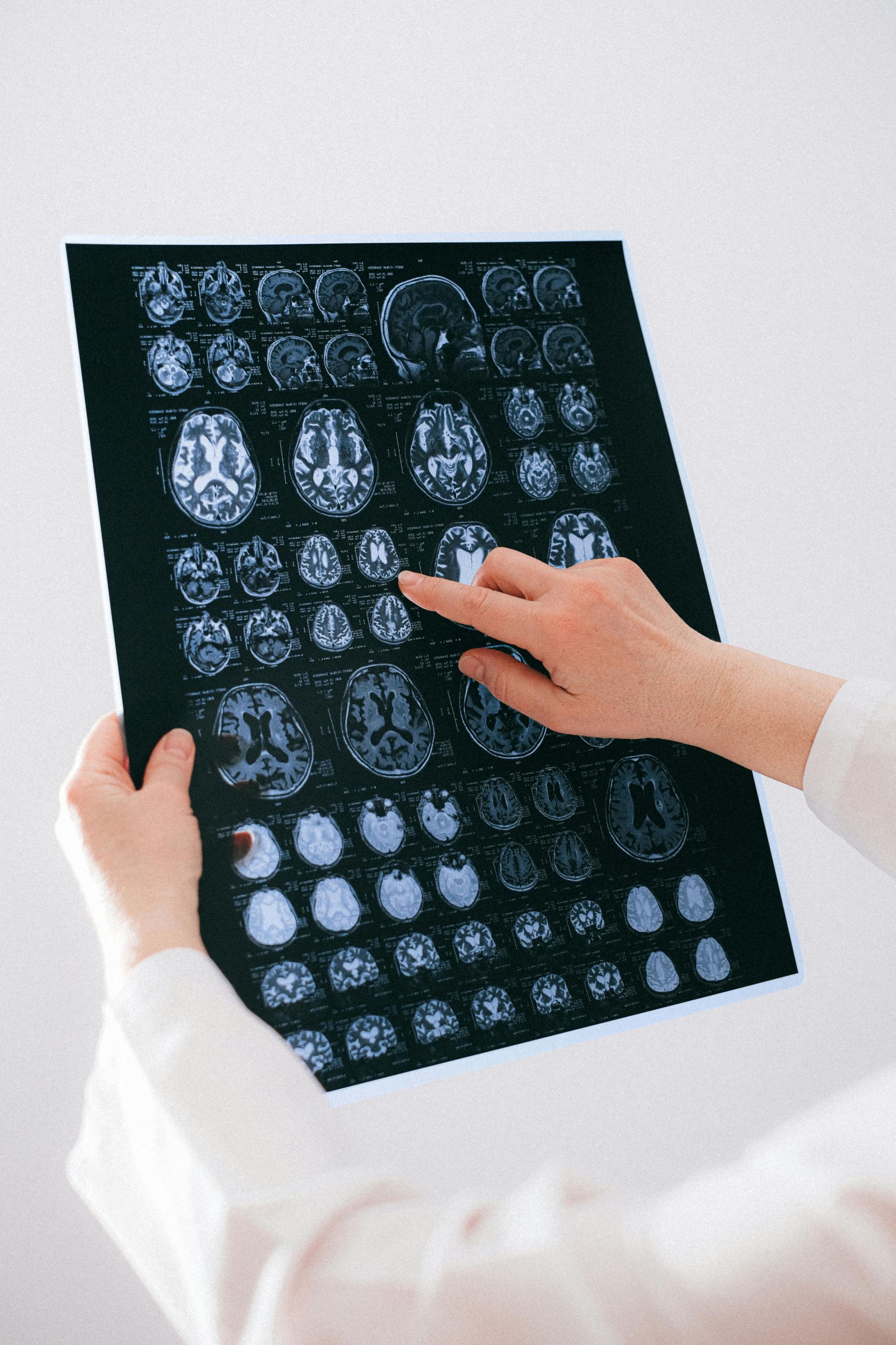 A person is holding a x-ray of a person 's brain.