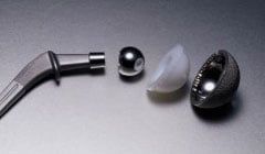 A close up of a surgical implant on a table.
