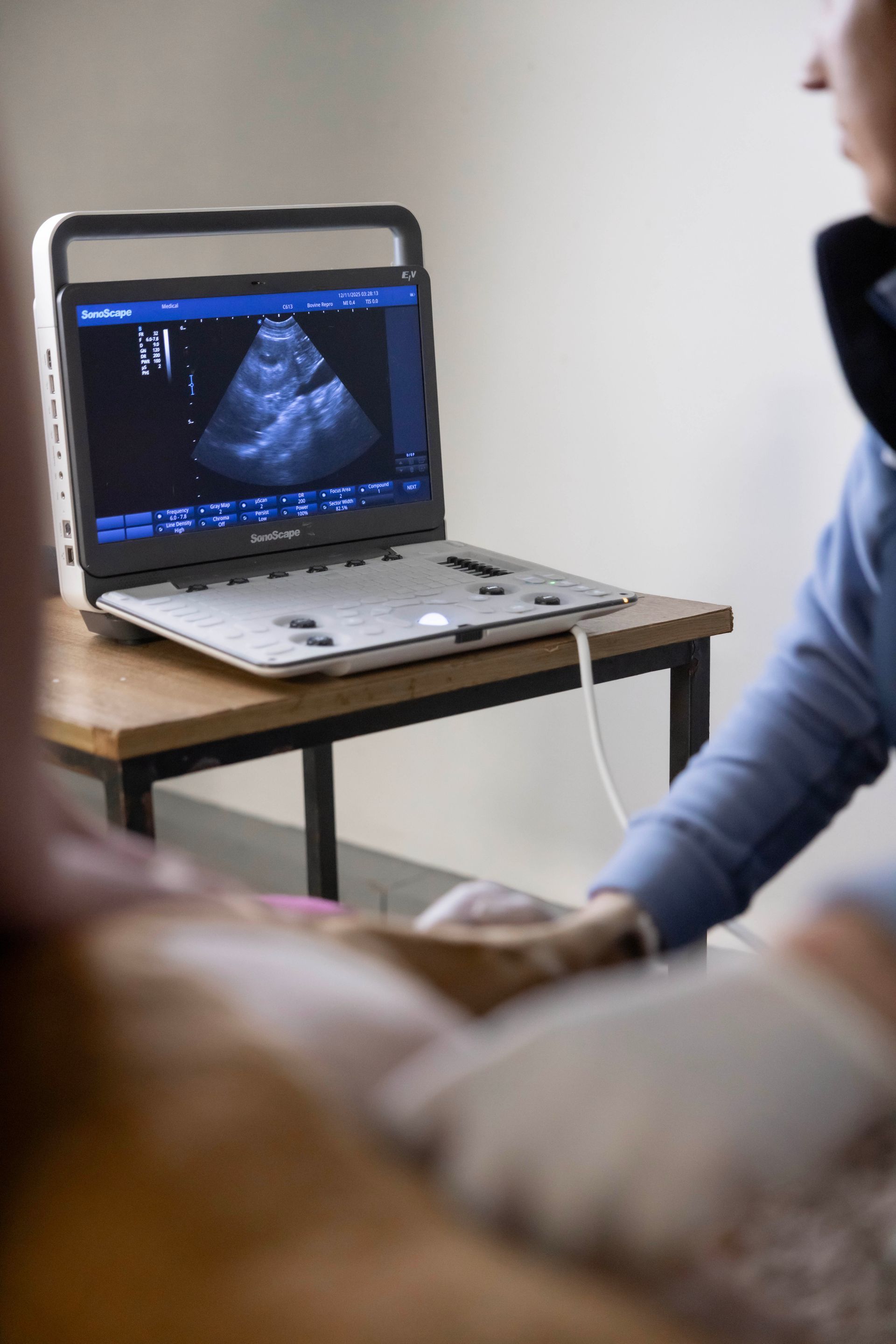 Laptop displaying an ultrasound beside a patient on a medical exam table