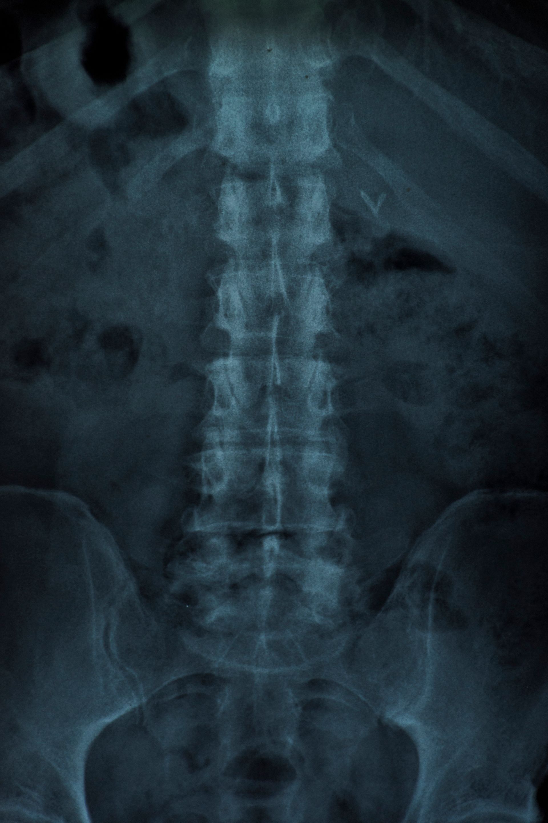 Venta proteccion radiologica para hospitales