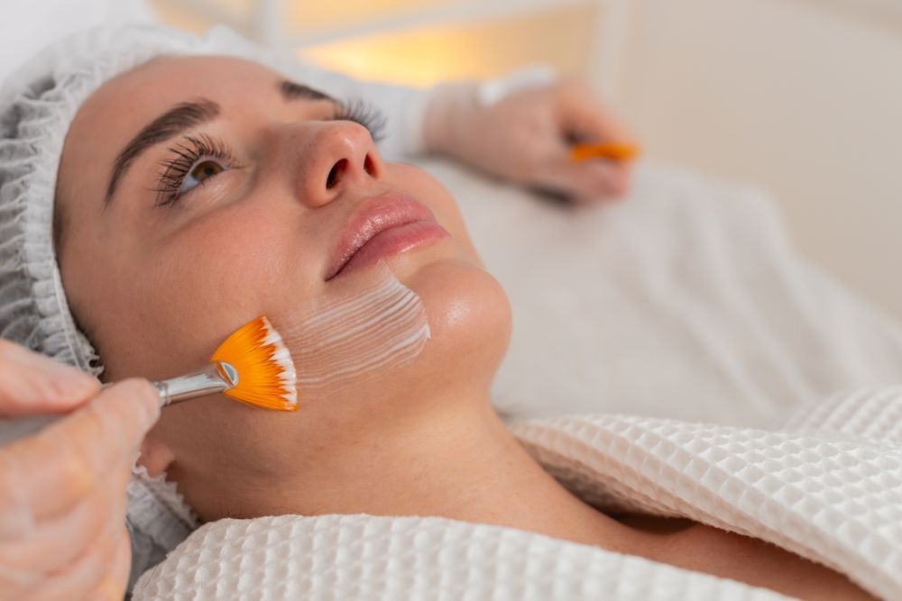 Chemical Peel