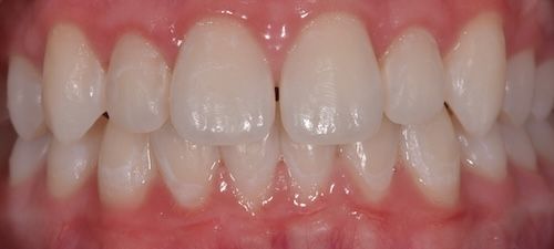 Close-up of healthy, straight teeth and pink gums.