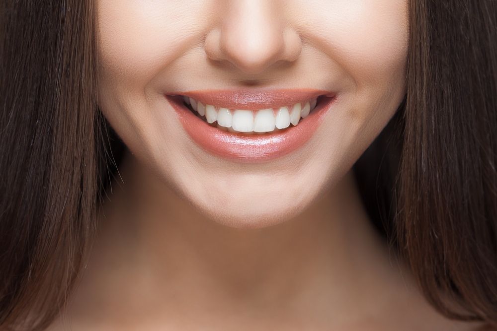 A Close Up Of A Woman 's Smile With White Teeth — Tweed City Dental in Tweed Heads South, NSW