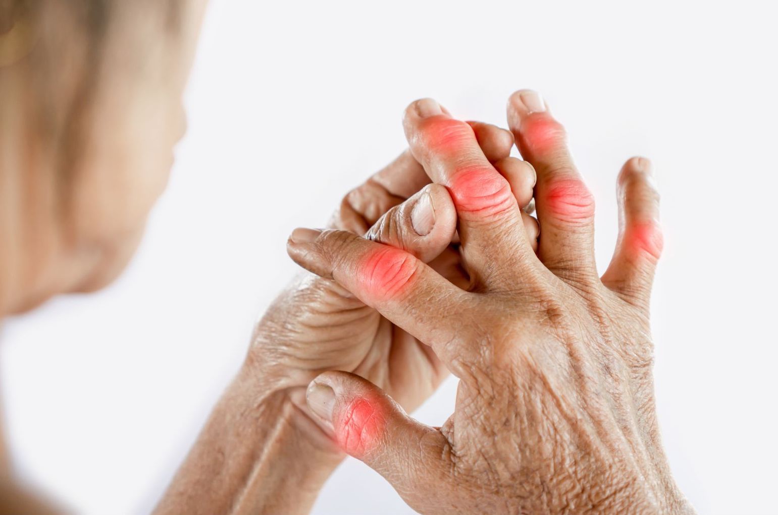 Close-up of hands showing Rheumatoid Arthritis symptoms in hands and fingers, with red highlights indicating areas of joint pain and swelling in multiple finger joints against a white background