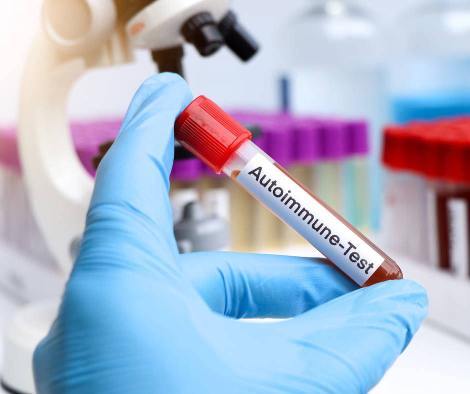A medical professional in blue protective gear pipettes arthritis blood samples at a laboratory