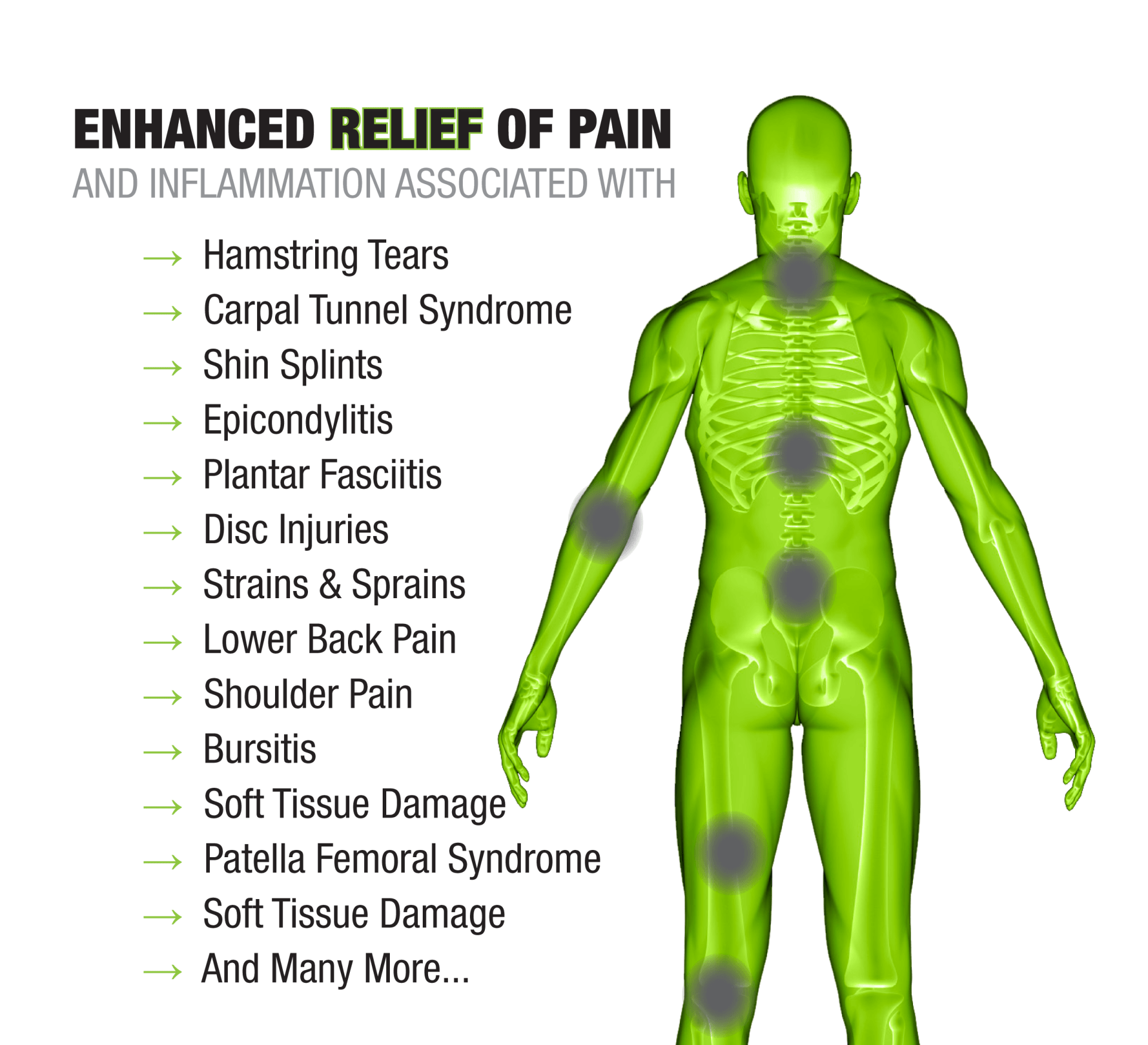 List Of Body Pain With A Body Portrait — Clarkesville, GA — Chiropractic Spine Center