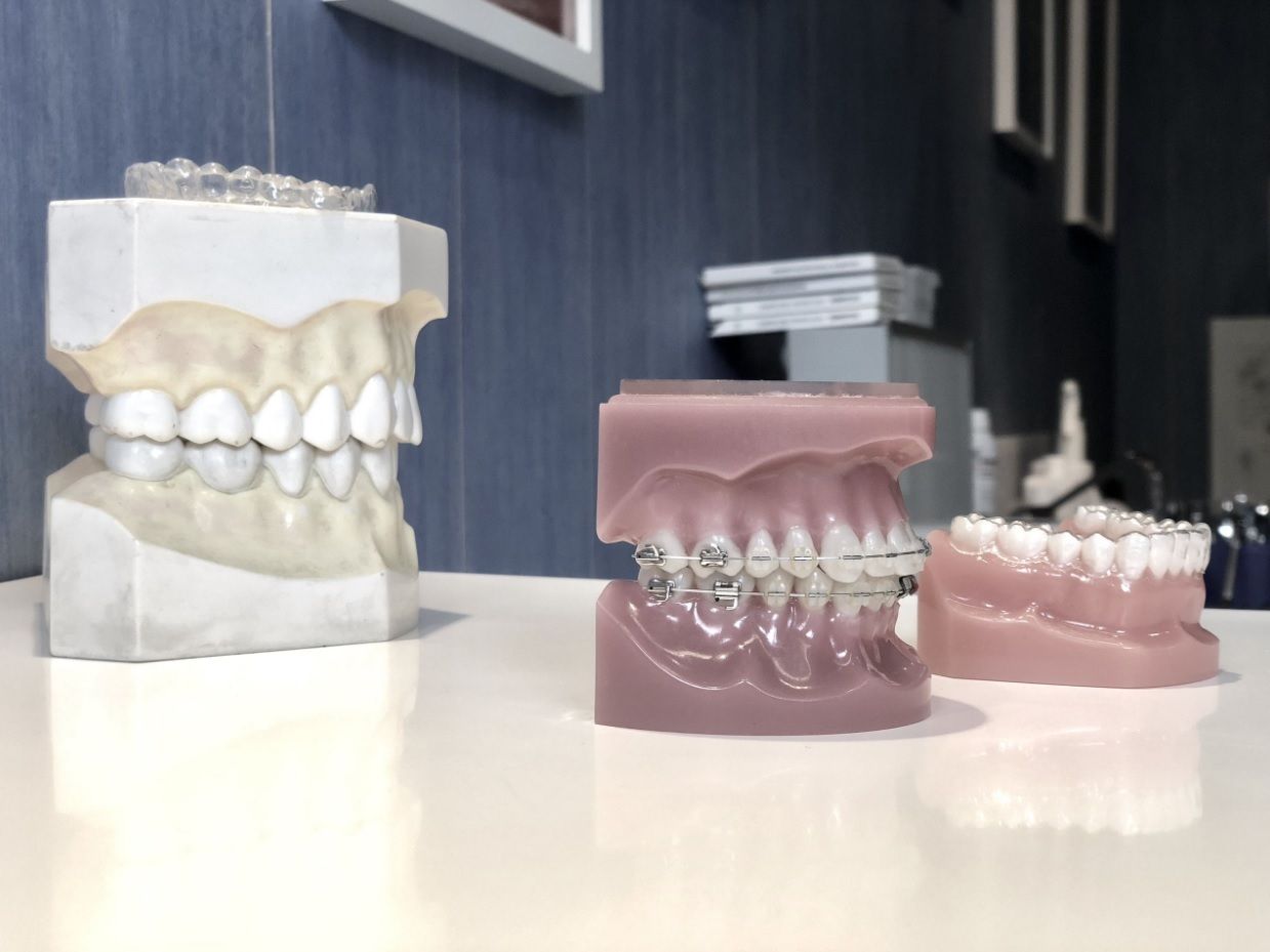 Traitement orthodontique avec bagues Genève