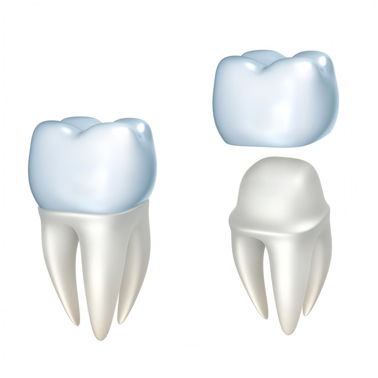 Tooth with crown: tooth with cap detached, showing tooth and crown separately, both white and blue.