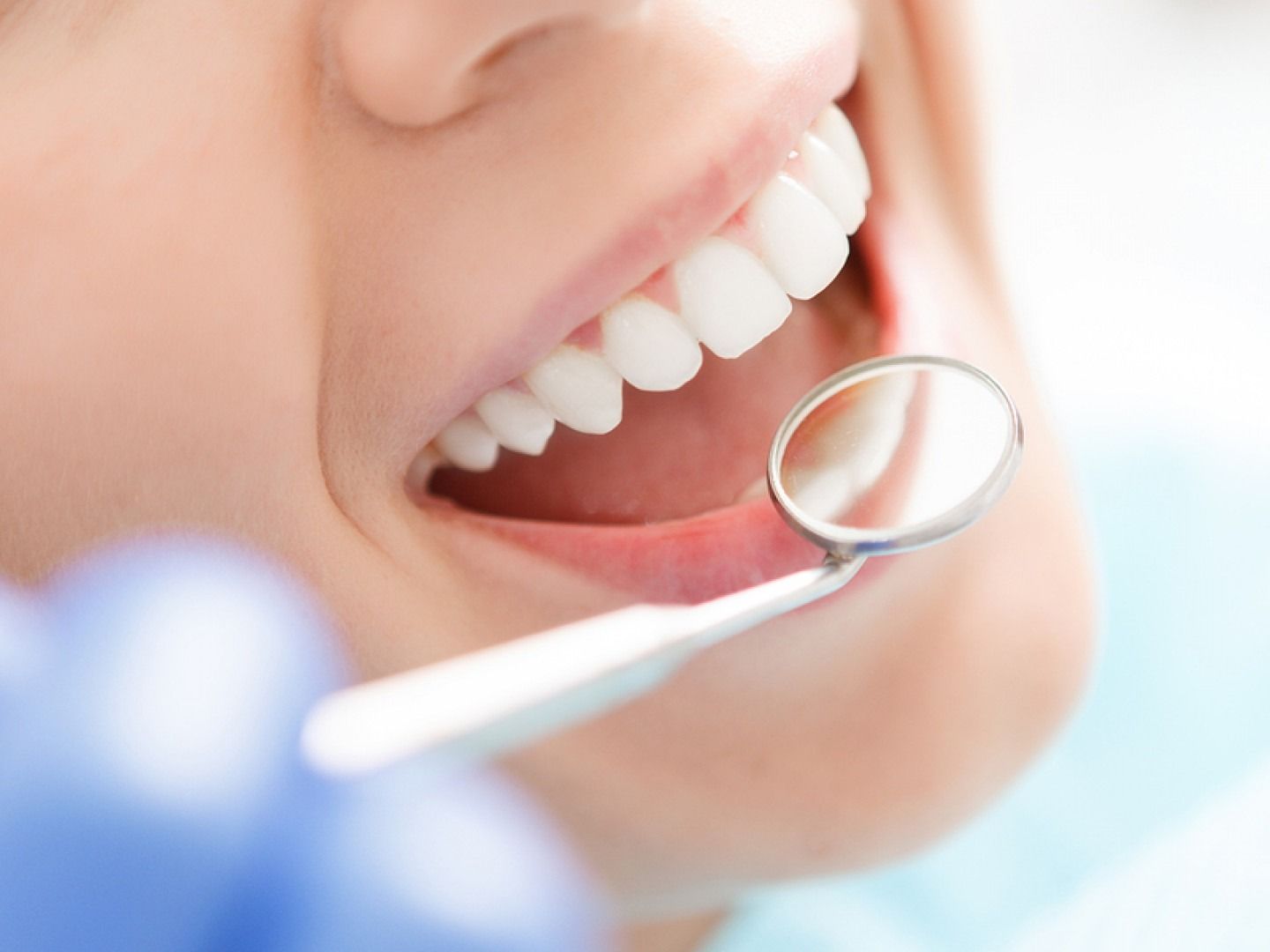 Close-up of teeth being examined with a dental mirror. Bright, white teeth and pink gums are visible.