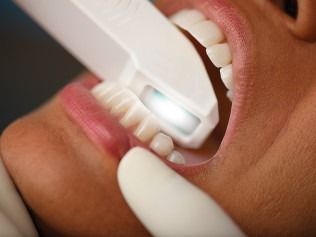Dentist using a white intraoral scanner on a patient's teeth during a dental examination.
